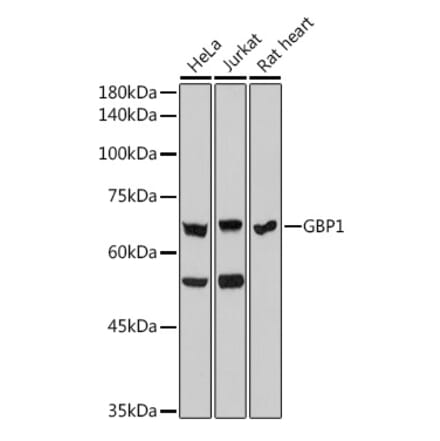 Western Blot - Anti-GBP1 Antibody [ARC2521] (A308580) - Antibodies.com