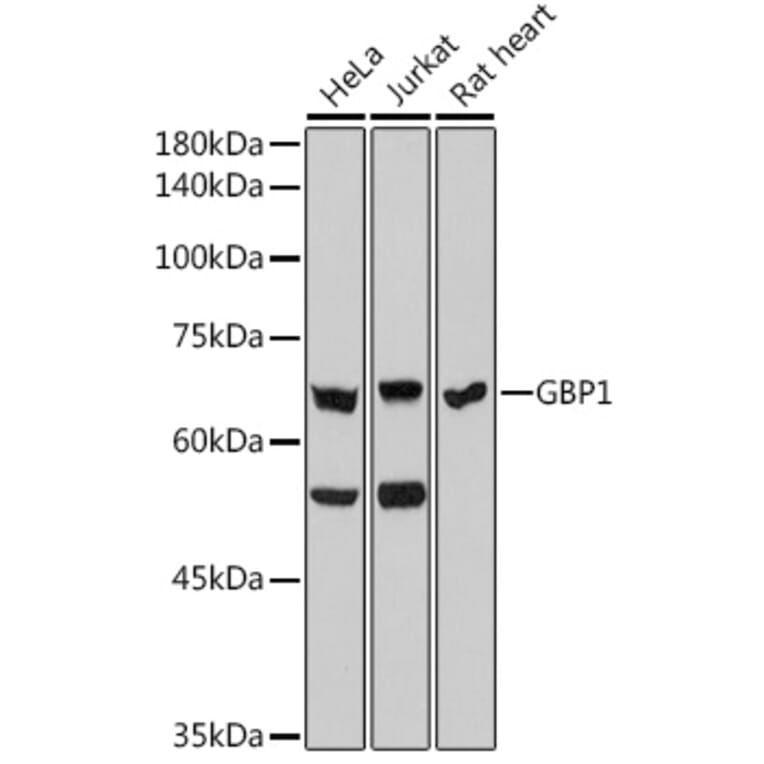 Western Blot - Anti-GBP1 Antibody [ARC2521] (A308580) - Antibodies.com
