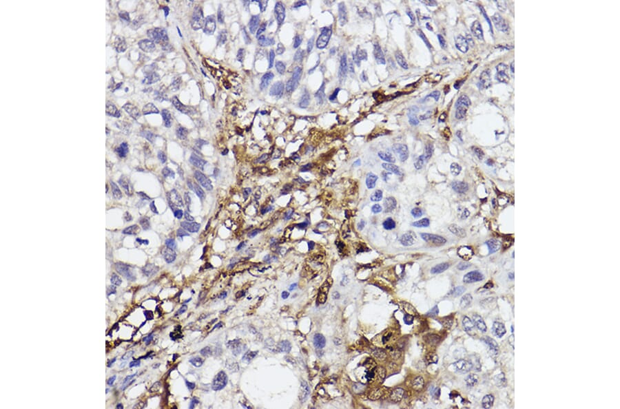 Immunohistochemistry - Anti-GBP1 Antibody [ARC2521] (A308580) - Antibodies.com