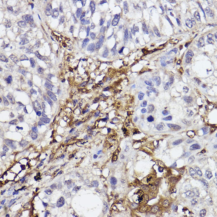 Immunohistochemistry - Anti-GBP1 Antibody [ARC2521] (A308580) - Antibodies.com