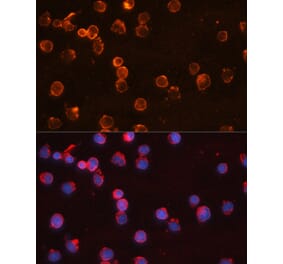 Immunofluorescence - Anti-IL-10 Antibody (A308581) - Antibodies.com