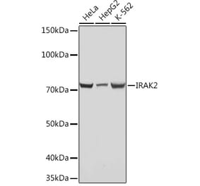 Western Blot - Anti-IRAK2 Antibody [ARC1078] (A308582) - Antibodies.com