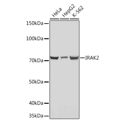 Western Blot - Anti-IRAK2 Antibody [ARC1078] (A308582) - Antibodies.com