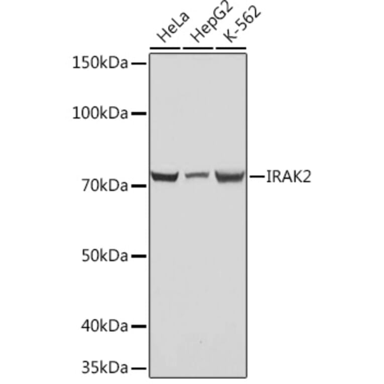 Western Blot - Anti-IRAK2 Antibody [ARC1078] (A308582) - Antibodies.com