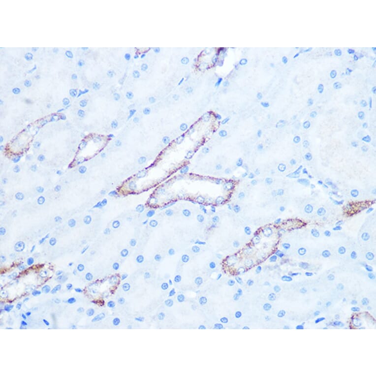 Immunohistochemistry - Anti-IRAK2 Antibody [ARC1078] (A308582) - Antibodies.com