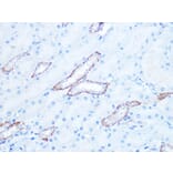Immunohistochemistry - Anti-IRAK2 Antibody [ARC1078] (A308582) - Antibodies.com