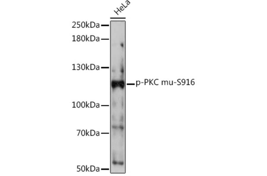 Western Blot - Anti-PKC mu/PKD (phospho Ser916) Antibody (A308584) - Antibodies.com