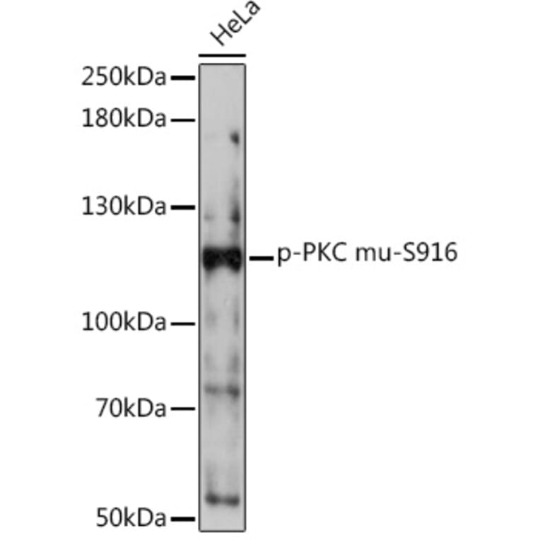 Western Blot - Anti-PKC mu/PKD (phospho Ser916) Antibody (A308584) - Antibodies.com