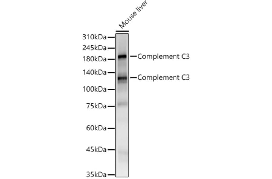 Western Blot - Anti-C3 Antibody [ARC56851] (A308585) - Antibodies.com