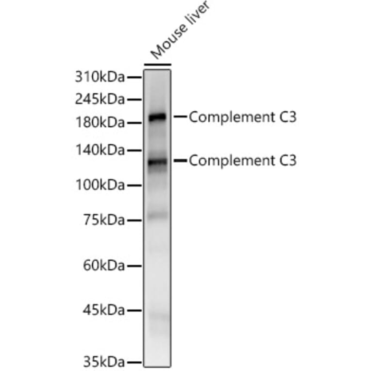 Western Blot - Anti-C3 Antibody [ARC56851] (A308585) - Antibodies.com