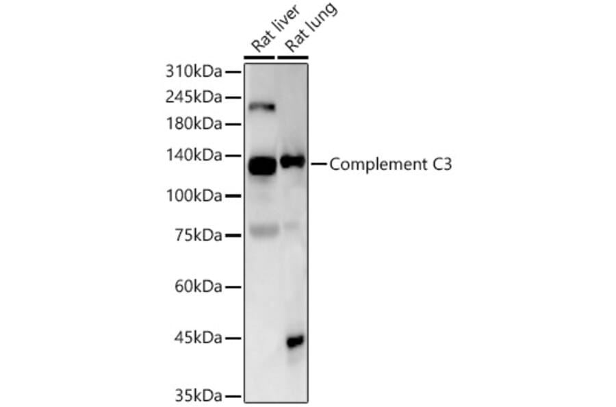 Western Blot - Anti-C3 Antibody [ARC56851] (A308585) - Antibodies.com