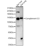 Western Blot - Anti-C3 Antibody [ARC56851] (A308585) - Antibodies.com