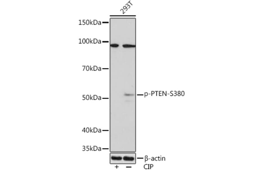 Western Blot - Anti-PTEN (phospho Ser380) Antibody [ARC1542] (A308588) - Antibodies.com
