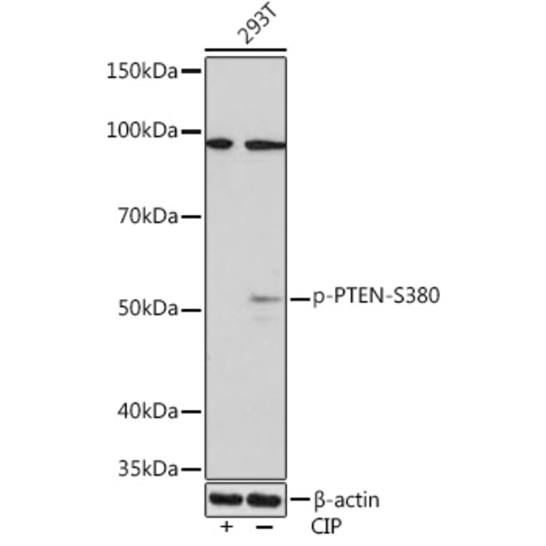 Western Blot - Anti-PTEN (phospho Ser380) Antibody [ARC1542] (A308588) - Antibodies.com