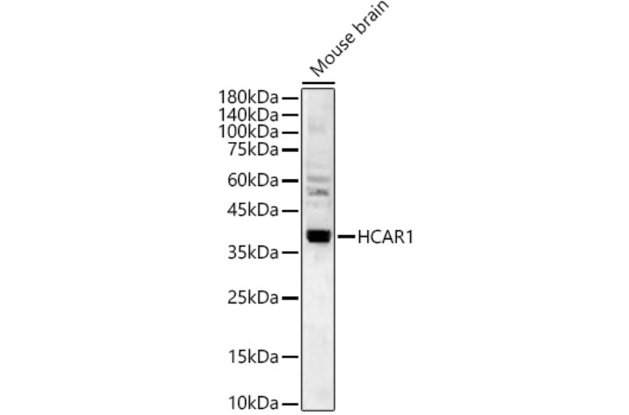 Western Blot - Anti-GPCR GPR81 Antibody (A308591) - Antibodies.com