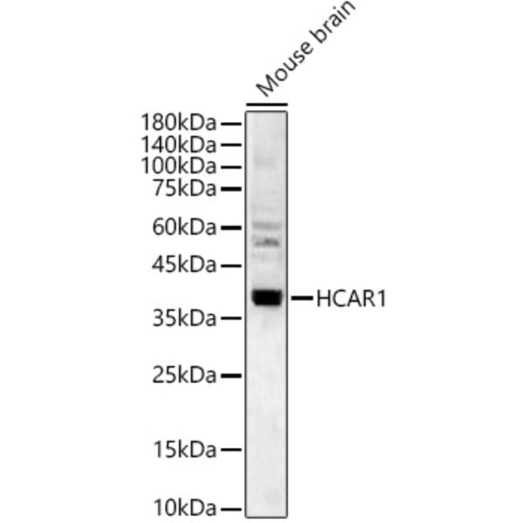 Western Blot - Anti-GPCR GPR81 Antibody (A308591) - Antibodies.com