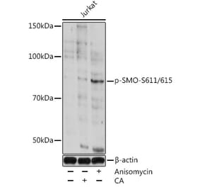Western Blot - Anti-Smoothened (phospho Ser611 + Ser615) Antibody (A308592) - Antibodies.com