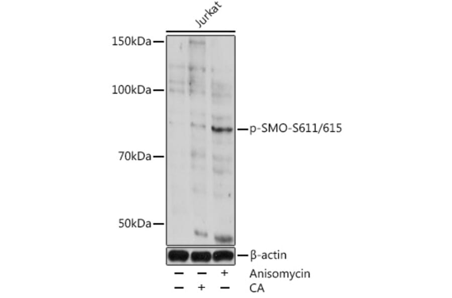 Western Blot - Anti-Smoothened (phospho Ser611 + Ser615) Antibody (A308592) - Antibodies.com