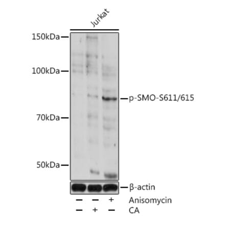 Western Blot - Anti-Smoothened (phospho Ser611 + Ser615) Antibody (A308592) - Antibodies.com