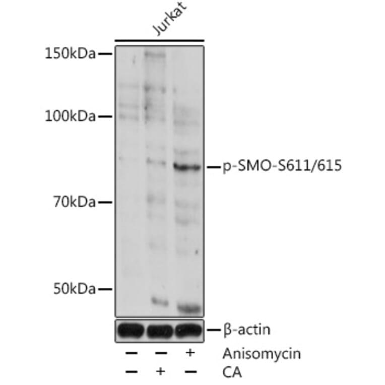 Western Blot - Anti-Smoothened (phospho Ser611 + Ser615) Antibody (A308592) - Antibodies.com