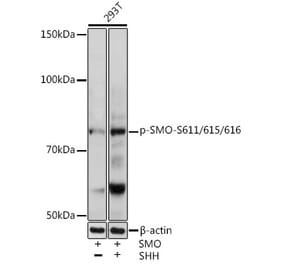 Western Blot - Anti-Smoothened (phospho Ser611 + Ser615 + Ser616) Antibody (A308593) - Antibodies.com