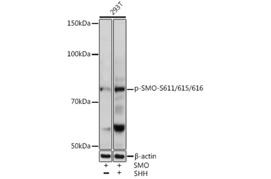 Western Blot - Anti-Smoothened (phospho Ser611 + Ser615 + Ser616) Antibody (A308593) - Antibodies.com