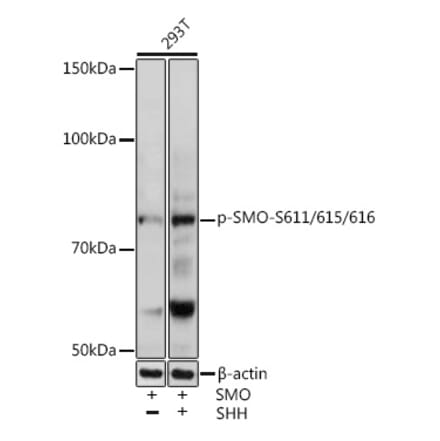 Western Blot - Anti-Smoothened (phospho Ser611 + Ser615 + Ser616) Antibody (A308593) - Antibodies.com