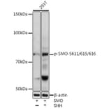 Western Blot - Anti-Smoothened (phospho Ser611 + Ser615 + Ser616) Antibody (A308593) - Antibodies.com