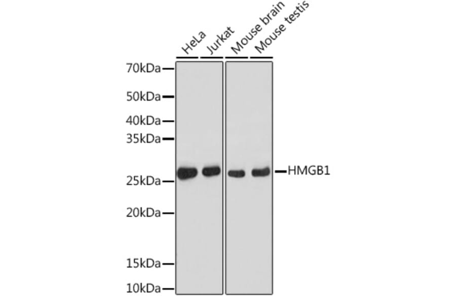 Western Blot - Anti-HMGB1 Antibody [ARC0001] (A308594) - Antibodies.com