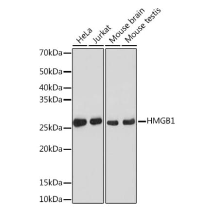 Western Blot - Anti-HMGB1 Antibody [ARC0001] (A308594) - Antibodies.com