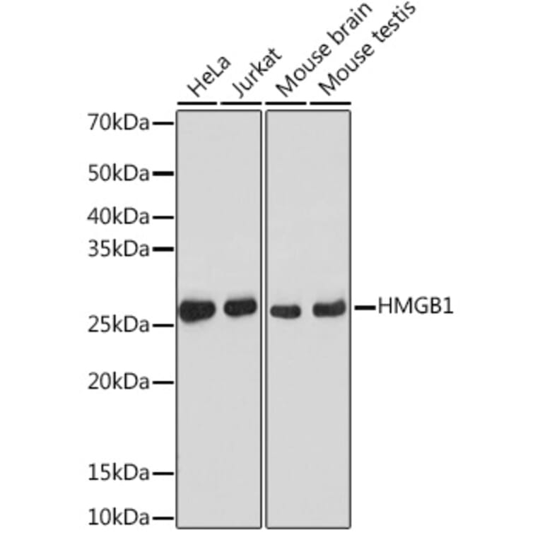 Western Blot - Anti-HMGB1 Antibody [ARC0001] (A308594) - Antibodies.com