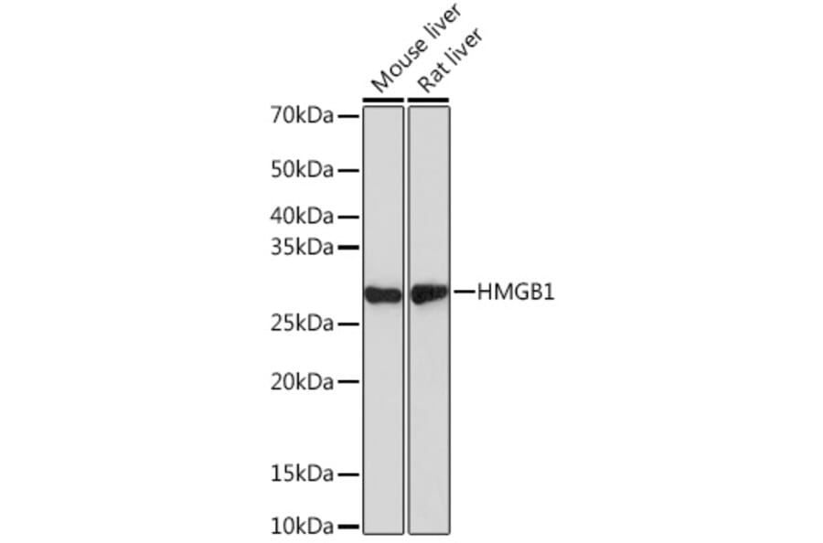 Western Blot - Anti-HMGB1 Antibody [ARC0001] (A308594) - Antibodies.com