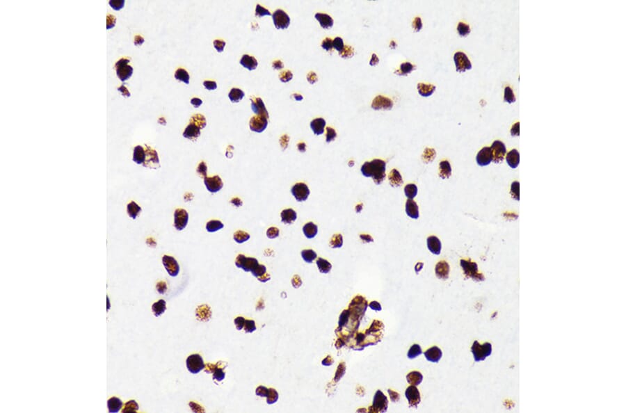 Immunohistochemistry - Anti-HMGB1 Antibody [ARC0001] (A308594) - Antibodies.com