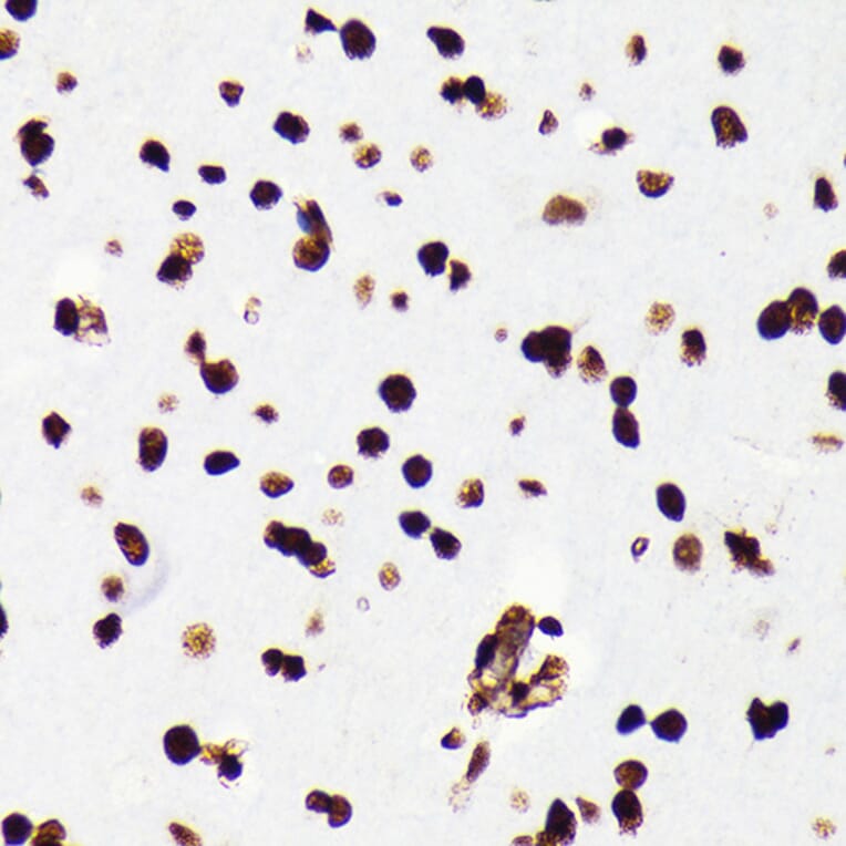 Immunohistochemistry - Anti-HMGB1 Antibody [ARC0001] (A308594) - Antibodies.com