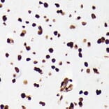 Immunohistochemistry - Anti-HMGB1 Antibody [ARC0001] (A308594) - Antibodies.com