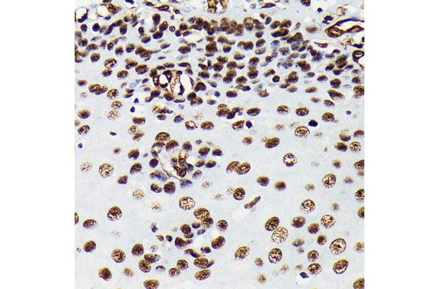 Immunohistochemistry - Anti-HMGB1 Antibody [ARC0001] (A308594) - Antibodies.com