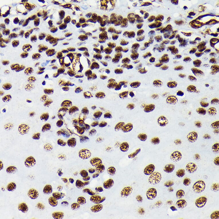 Immunohistochemistry - Anti-HMGB1 Antibody [ARC0001] (A308594) - Antibodies.com