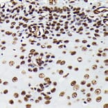 Immunohistochemistry - Anti-HMGB1 Antibody [ARC0001] (A308594) - Antibodies.com