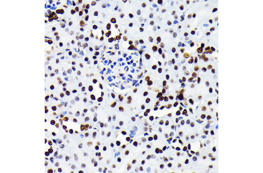 Immunohistochemistry - Anti-HMGB1 Antibody [ARC0001] (A308594) - Antibodies.com