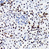 Immunohistochemistry - Anti-HMGB1 Antibody [ARC0001] (A308594) - Antibodies.com