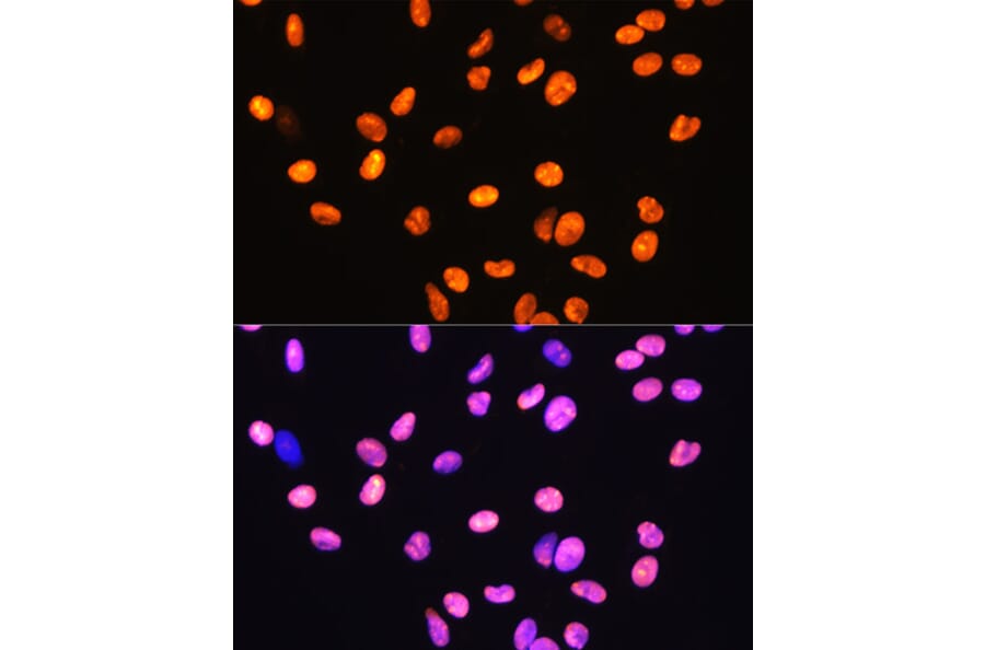 Immunofluorescence - Anti-HMGB1 Antibody [ARC0001] (A308594) - Antibodies.com