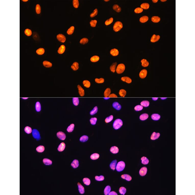 Immunofluorescence - Anti-HMGB1 Antibody [ARC0001] (A308594) - Antibodies.com