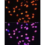 Immunofluorescence - Anti-HMGB1 Antibody [ARC0001] (A308594) - Antibodies.com