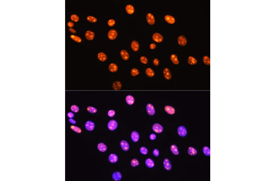 Immunofluorescence - Anti-HMGB1 Antibody [ARC0001] (A308594) - Antibodies.com