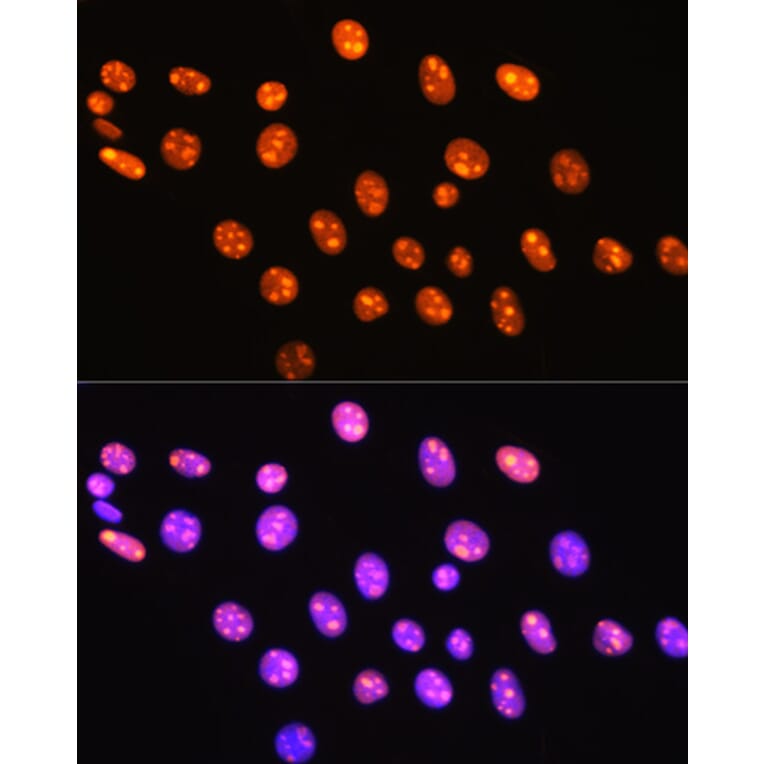 Immunofluorescence - Anti-HMGB1 Antibody [ARC0001] (A308594) - Antibodies.com