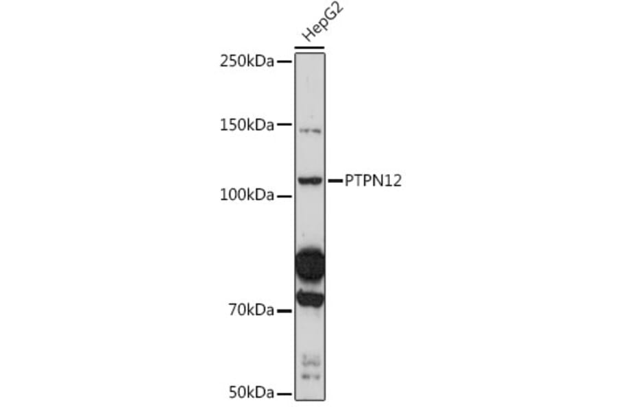 Western Blot - Anti-PTPN12 Antibody (A308595) - Antibodies.com