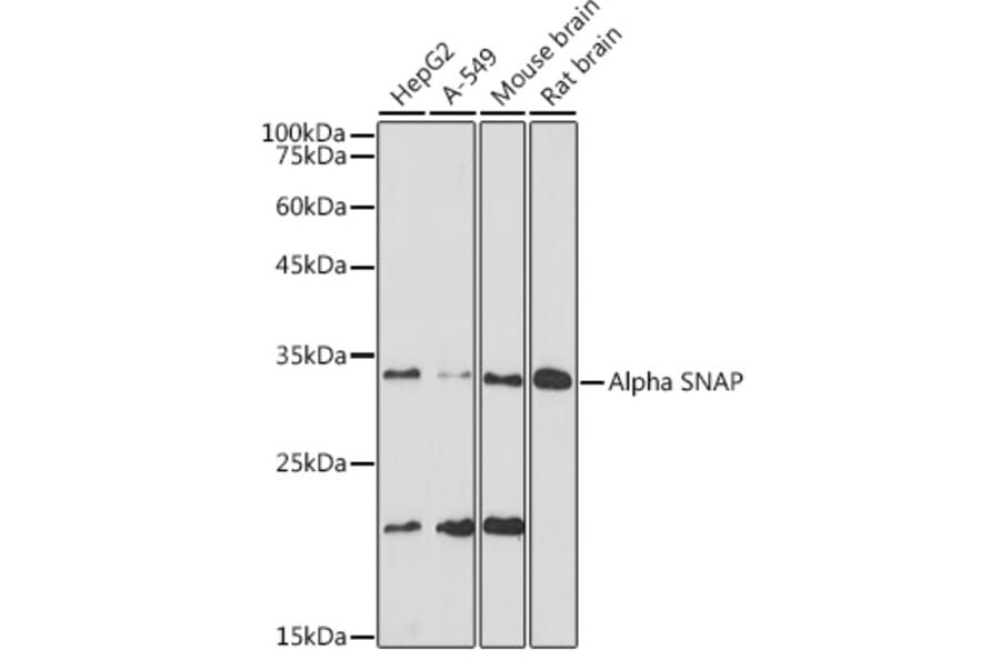 Western Blot - Anti-alpha SNAP Antibody [ARC2382] (A308596) - Antibodies.com