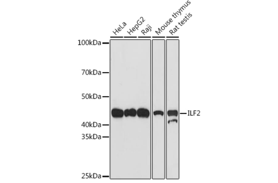 Western Blot - Anti-ILF2/NF45 Antibody [ARC1621] (A308598) - Antibodies.com