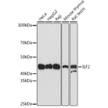 Western Blot - Anti-ILF2/NF45 Antibody [ARC1621] (A308598) - Antibodies.com