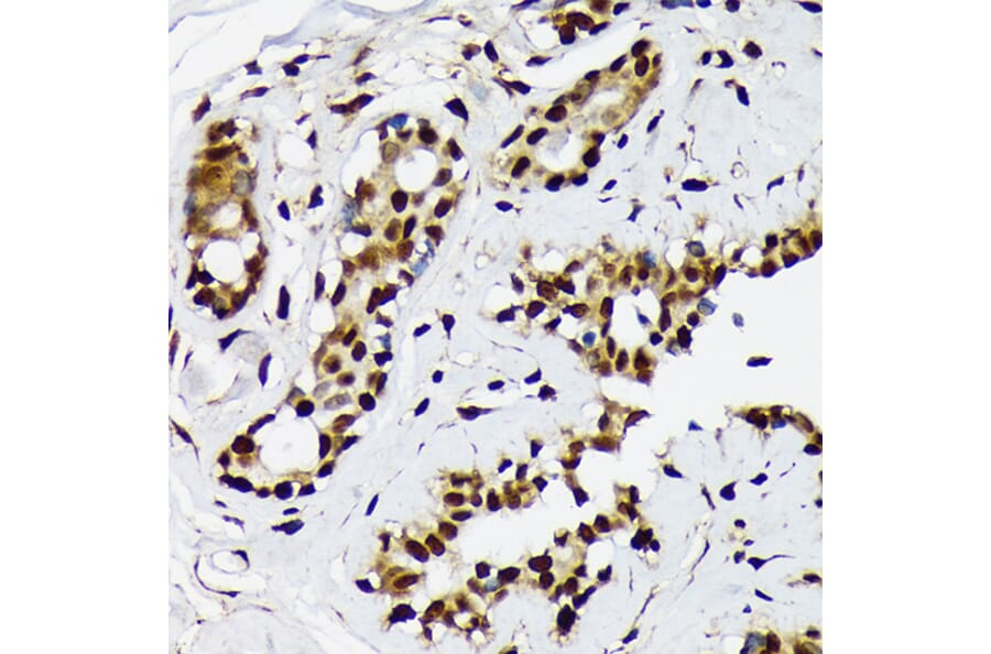 Immunohistochemistry - Anti-ILF2/NF45 Antibody [ARC1621] (A308598) - Antibodies.com